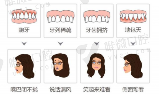 补牙材质日本还是美国的好（日本补牙材料都有哪些）(图1)